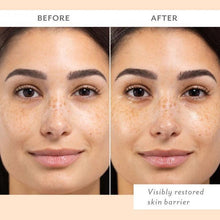 Load image into Gallery viewer, Skin Remedy Barrier-Boosting Sheet Mask