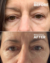 Load image into Gallery viewer, First Light Vitamin C + Caffein Eye Cream