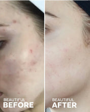 Load image into Gallery viewer, Dew Drops Serum