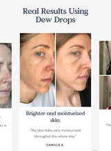 Load image into Gallery viewer, Dew Drops Serum